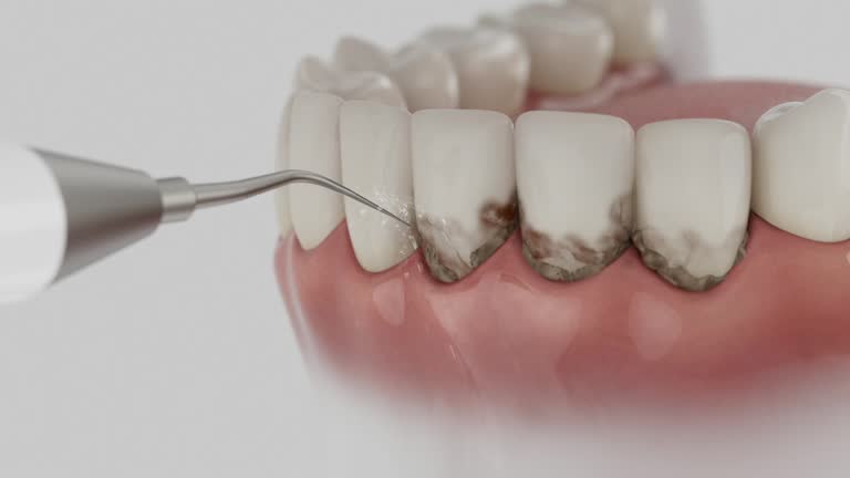 Trusted Teeth Cleaning And Checkup service in Blue Bell, PA - Dentist Open Now